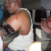 Bayelsa Gov Poll: Brass Local Council PDP Chairman Suffers Head Injury After Alleged Brutalisation By APC Thugs Over Election Materials